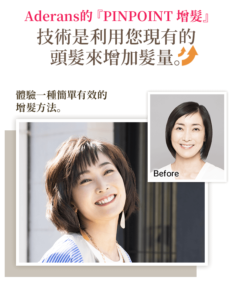Aderans的『PINPOINT』技術是利用您現有的頭髮來增加髮量。