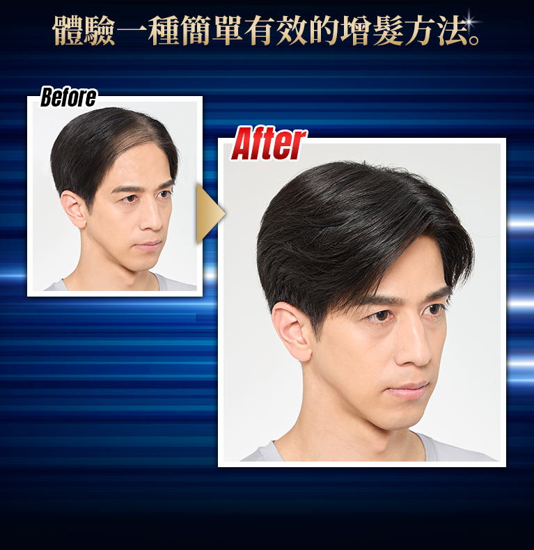 技術是利用您現有的頭髮來增加髮量
