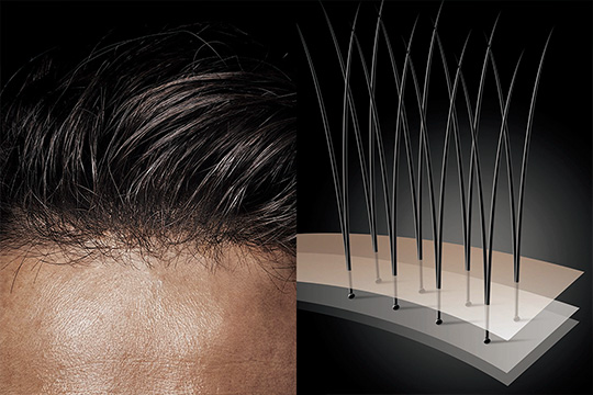 不要放棄對秀麗毛髮嘅的追求！