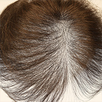 可拆卸式 隨時除下的夾子方法