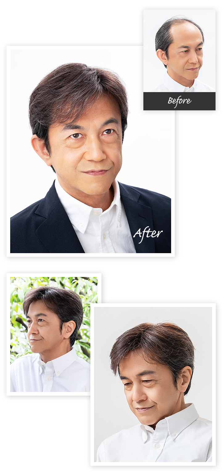 Aderans 假髮 個案2