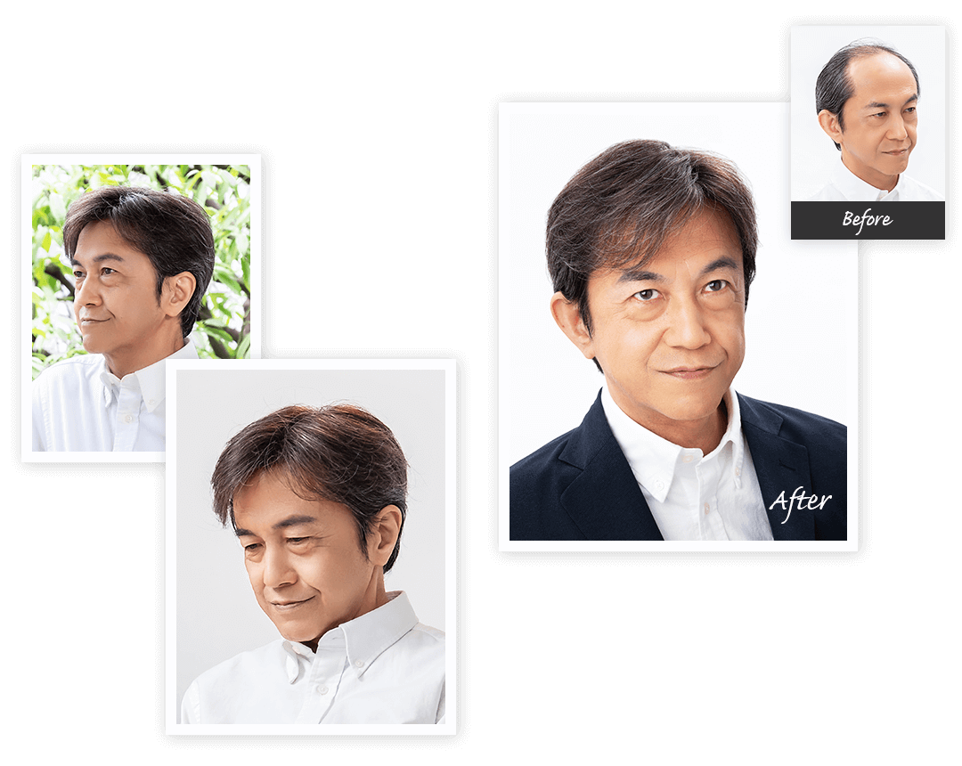 Aderans 假髮 個案2