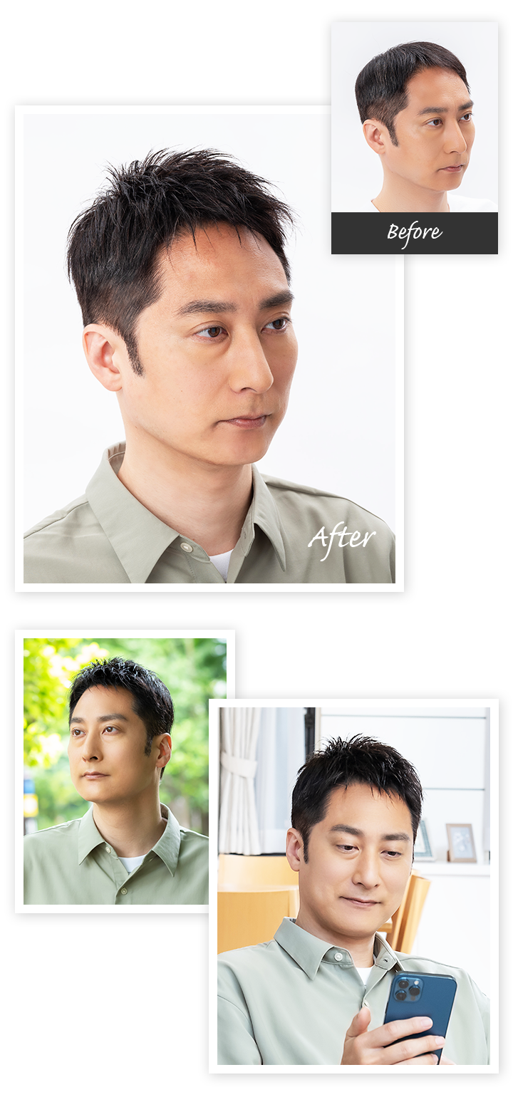 Aderans 假髮 個案3