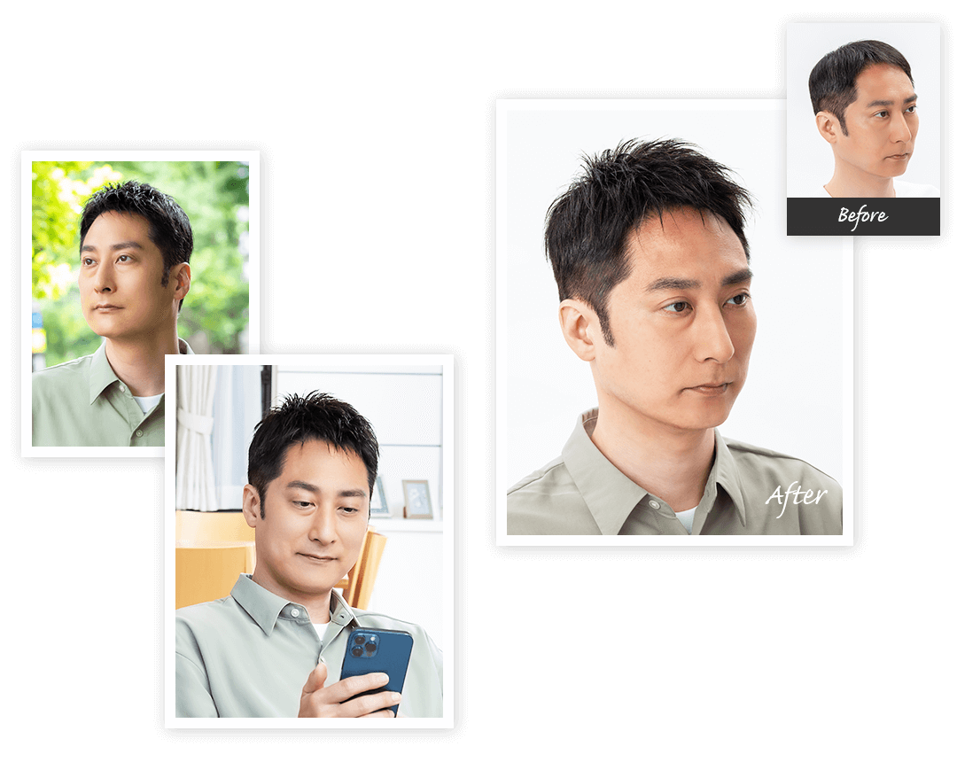 Aderans 假髮 個案3